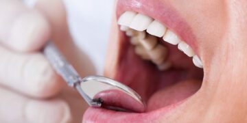 Grávida pode fazer tratamento dentário