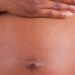Violência obstétrica: mulheres negras sofrem mais