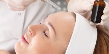 Melasma na gravidez: como tratar?