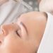 Melasma na gravidez: como tratar?