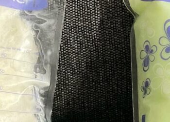 A foto do leite materno com cor esverdeada circulou pela internet: médico explica que não tem relação com anticorpos contra covid-19