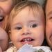 Lua, filha de Tiago Leifer e Daiana Garbin, foi diagnosticada com retinoblastoma: a importância de levar o bebê ao oftalmopediatra